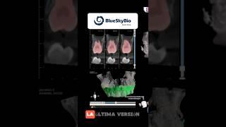 BlueSkyBio #shorts #bluesky #blueskybio #blueskybiodigital #odontologiadigital #odontologia