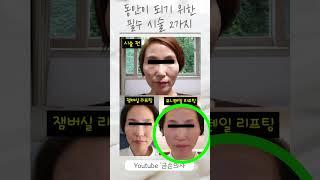 10년 이상 어려보이는 2가지 리프팅 시술