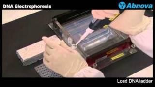 DNA Electrophoresis