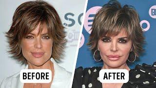 How Cosmetic Procedures Changed 15 Famous Women