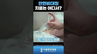 안면비대칭 치료는 어디서? #안면비대칭치료 #안면비대칭교정