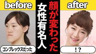 【ガルちゃん芸能】誰か分かる？昔と比較すると顔が変わった女性有名人【整形】【有益2ch】