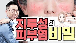 지루성피부염의 5가지 거짓말 | 독소배출, 땀배출, 운동, 물세안, 천연화장품 | 왜 믿는가?