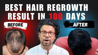 Best hair treatment of india  | Best minoxidil result in 100 days | 100% Regrowth | Waidon hair