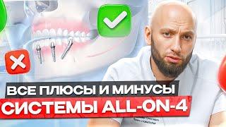 Как Вернуть Красивую Улыбку за несколько дней. Система "ВСЕ НА 4" / "ALL ON 4" !