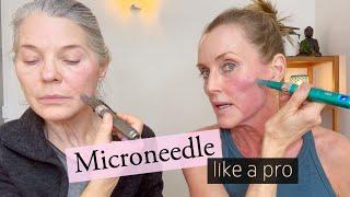 How to SAFELY & EFFECTIVELY Medical Microneedle - Full Demo Beginner to Advanced & what to use after