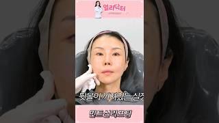 40대 실리프팅 &마리오네트필러 복합시술 #무보정#민트실리프팅#마리오네트필러#턱라인교정