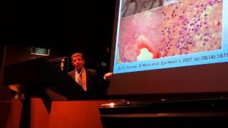 Neoatherosclerosis and OCT Talk Introduction