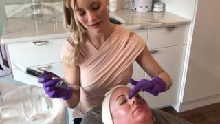 Willow Med Spa & Salon Collagen PIN - MicroNeedling