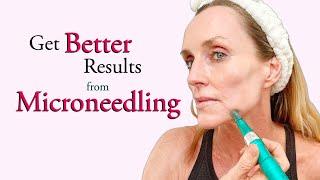 A BETTER way to Microneedle- Full Demo & The Difference between Cosmetic & Medical Microneedling