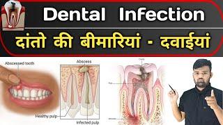 दांतो का संक्रमण | Dental Infection | Medicine | Medicine knowledge | Doctor | Dentist | Nursing