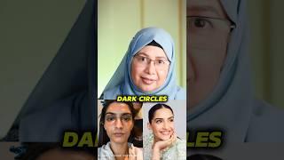 dark circle makeup tutorial #certifiedmakeupartist #professionalmakeupclass #jaipurmakeupartist
