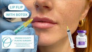 Lip Flip with Botox #botox #lipflip #botoxlipflip #botoxtreatment #botoxinjections #botoxfiller