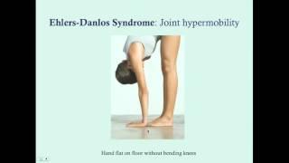 Ehlers-Danlos Syndrome - CRASH! Medical Review Series