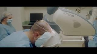 Robotic Hair Transplant Patient Recounts Experience at Bernstein Medical