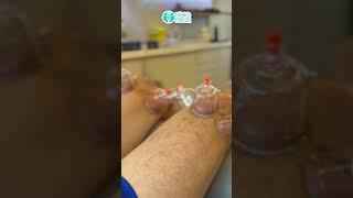 Tratamento com ventosaterapia