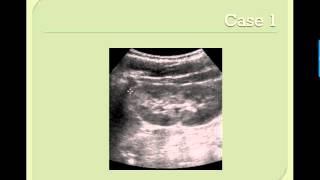 Renal Ultrasound Case Based MS3 Video