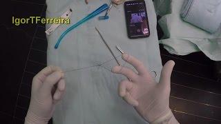 How to Make Laparoscopic Endoloop in 37 seconds!