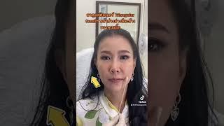 คุณเอิ๊ก พรหมพร มาปรับยกพยุงหน้าด้วยการฉีดฟิลเลอร์ เทคนิค triangular facelift #ฟิลเลอร์