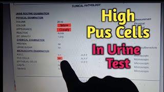 Urine Test Report Reading | Pus Cells In Urine Routine Examination | Urine Test In Hindi,Dr Lokendra