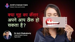 क्या मूह का कैंसर अपने आप ठीक हो सकता है? | Can mouth cancer get cured on its own? |  Dr Amit C