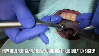 How To Do Root Canal Using Wave One Endo System and DryShield Technology #waveone#dryshield