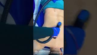 Laser Hair removal at smile up clinic #ytshorts #laser #youtubeshorts #trendingshorts
