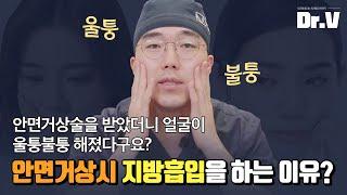 [日 SUB / 中] 안면거상 수술 후 울퉁불퉁해졌다고요? (안면거상술+지방흡입을 하는 이유!)