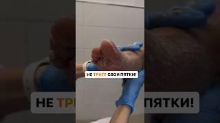 Не трите пятки. Пемза и терка для стоп.