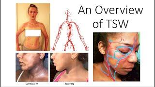 An Overview of TSW (Topical Steroid Withdrawal)