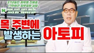 4K)목부위 목부위 아토피의 원인과 치료 방법은?아토피의 증상과 음식은?