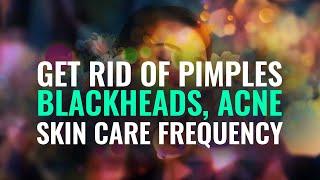 Clear Skin Subliminal: Forced Powerful Beats to Get Rid of Acne and Scars