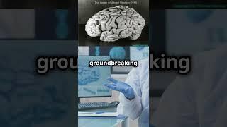 Einstein's Brain Went Missing!  #science   #einstein  #brainscience