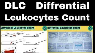 DLC | Diffrential Leukocyte Count in hindi | ph patho hub DLC | Staning method | #dmlt #bmlt