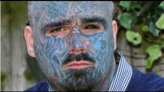 Britain’s Most Tattooed Man Pays £6,000 For Laser Removal – Matthew Whelan