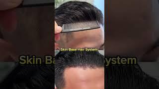 Skin Base Hair Patch System I 100 % Natural Look #hairreplacement #hairsystem