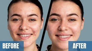 How to Use the Healing Brush Tool in Photoshop | Best Photoshop Tutorial | @BeingMuradShabir