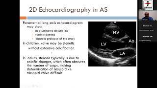 07 2024 06 21 20 45 13 Basics of Aortic stenosis Pul stenosis How to do it  Dr Sameer Shrivastava