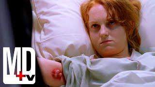 Woman Catches the BUBONIC PLAGUE | House M.D. | MD TV