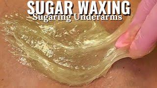 SUGARING UNDERARMS | SUGAR WAX #waxing #sugaring #hairremoval #sugarwax