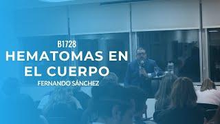 ¿POR QUÉ ME SALEN HEMATOMAS EN EL CUERPO? Buenos Aires B1728