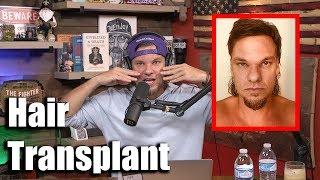 Theo Von talks FUE hair transplant procedure