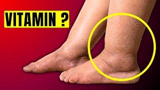 #1 Vitamin to Eliminate Swelling in Feet and Legs | HealthQuest