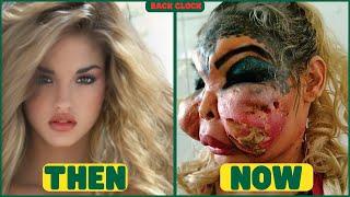 Famous Celebrities Unrecognizable After Plastic Surgery Gone Wrong | Then and Now 2024