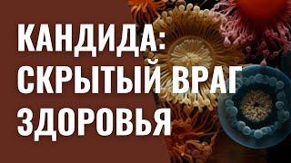 Кандида: скрытый враг здоровья.