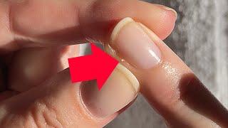 How to remove a hangnail like a PRO! [Pro Nail Technician Explains]