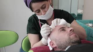 Hair Transplantation Process in 3 minutes