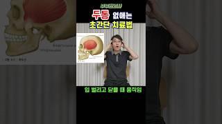 377. 두통 없애는 초간단 치료법 ㅣft 부부한의사