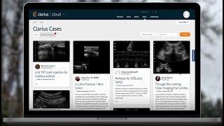 How to Use Clarius Cloud | Handheld Ultrasound Using Smartphones and Cloud | Clarius Ultrasound