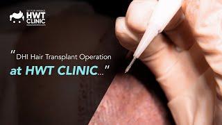 DHI Hair Transplant Operation at HWT CLINIC